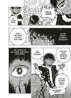 Cataract # 01